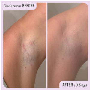 First Aid Beauty INGROWN HAIR PADS WITH BHA & AHA