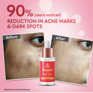 Chic Nutrix Outshine Korean Glass Skin Serum - Brightening & Dark Spot Corrector (30ml)