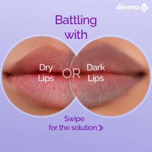 The Derma Co 1% Kojic Acid Lip Balm With Alpha Arbutin & Hyaluronic Acid - 4g