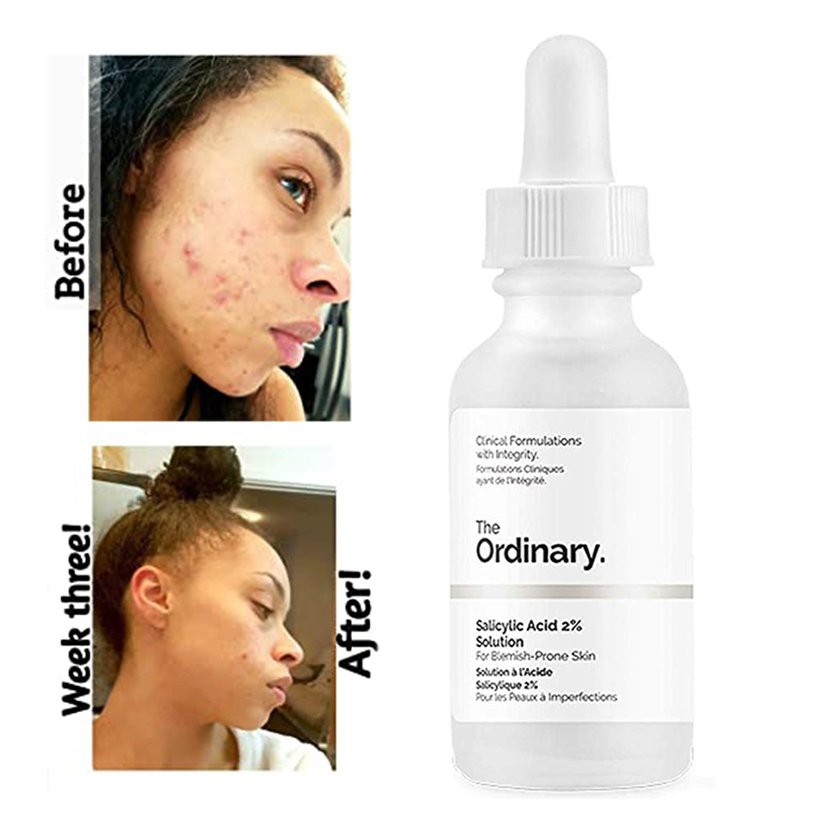 The Ordinary Salicylic Acid 2% Solution
